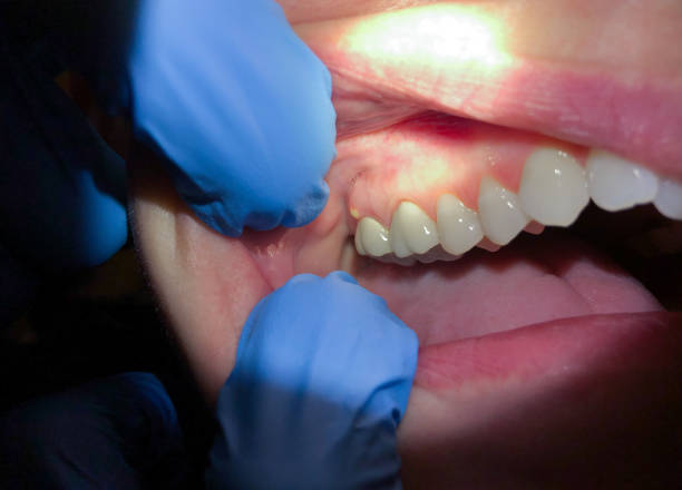 Best Tooth Infection Emergency Dentist  in Buzzards Bay, MA